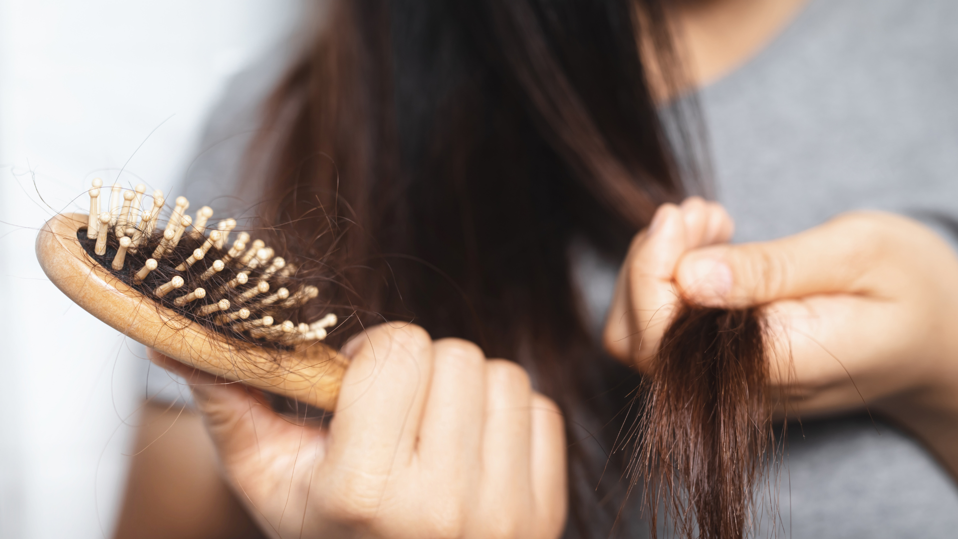 Hair Loss in the Bariatric Community